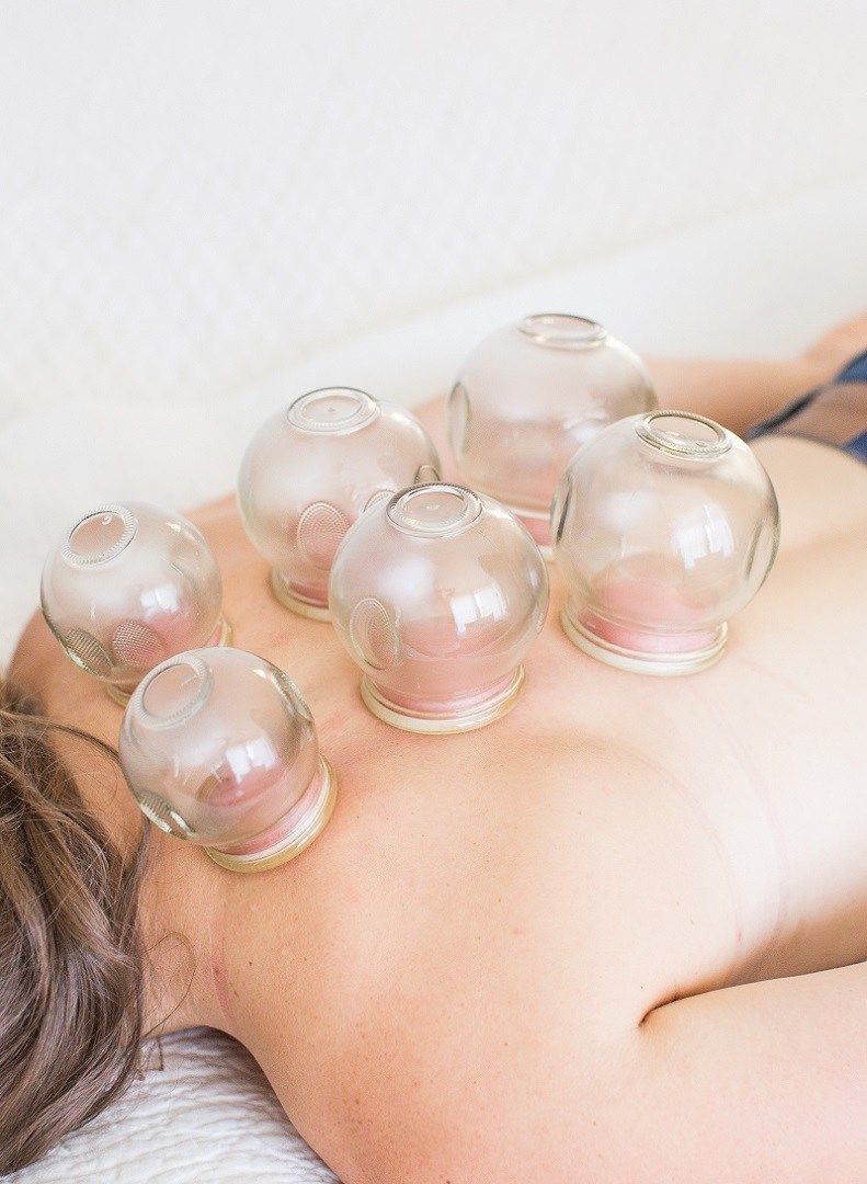 Cupping / 拔罐示意图